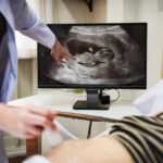 Ultrasound untuk Kehamilan
