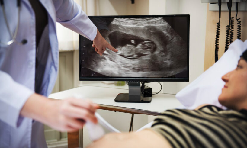 Ultrasound untuk Kehamilan