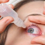 jenis obat tetes mata