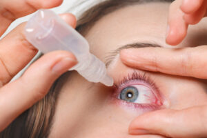 jenis obat tetes mata